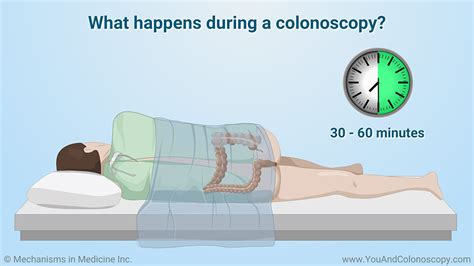 Both findings are in line with. . Left side pain after colonoscopy
